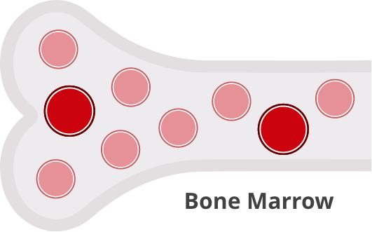 Immature red blood cells piling up in bone marrow and unable to enter the bloodstream to do their job