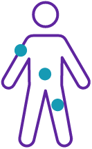REBLOZYL® (luspatercept-aamt) injection locations