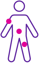 REBLOZYL® (luspatercept-aamt) injection locations